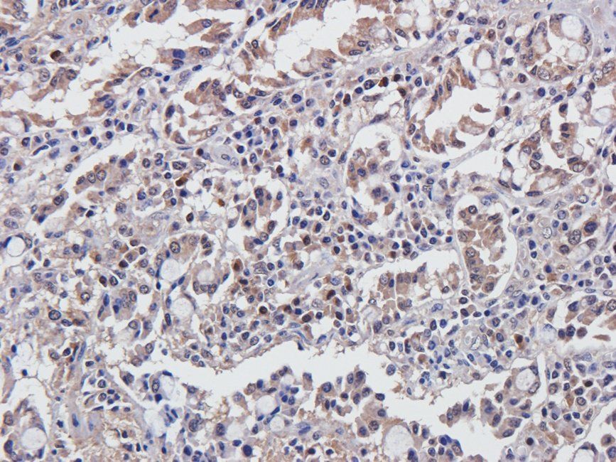 CDH17 Rabbit Polyclonal Antibody