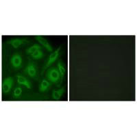 CDH23 Antibody