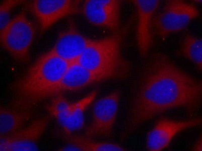 CDK1 Antibody