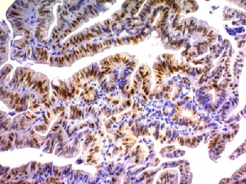 CDKN1A Antibody