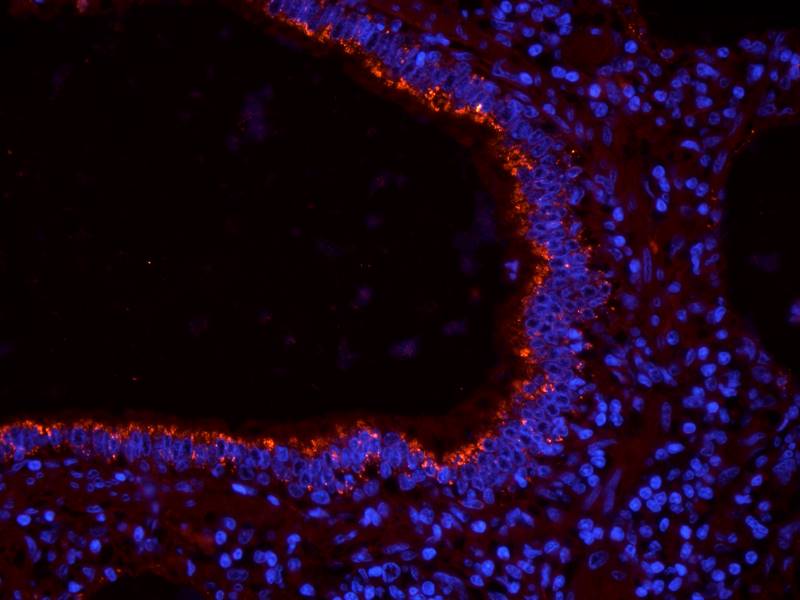 CDKN2A Rabbit Polyclonal Antibody