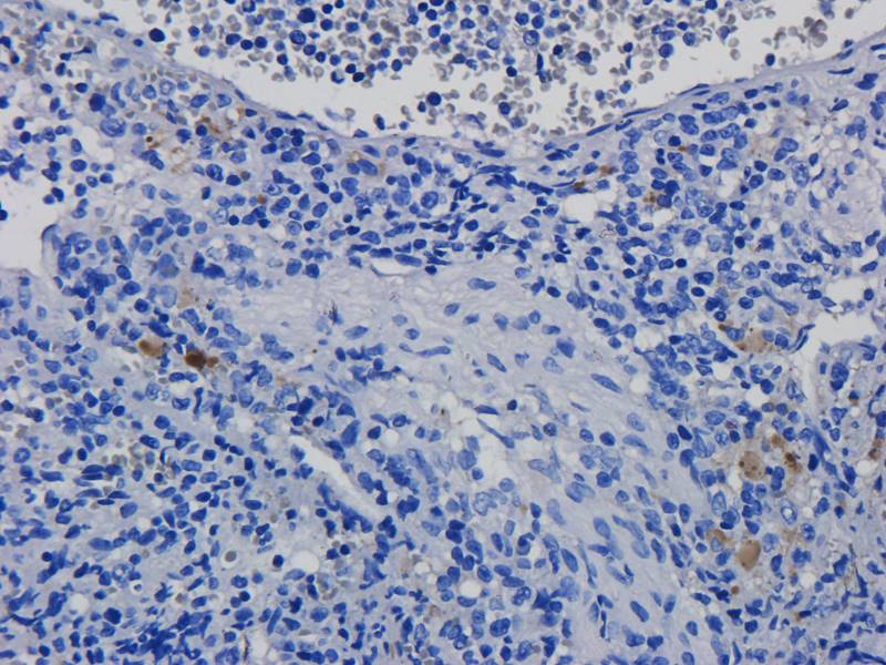 CDKN2A Rabbit Polyclonal Antibody
