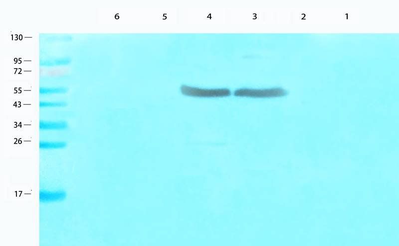 CDKN2A Rabbit Polyclonal Antibody