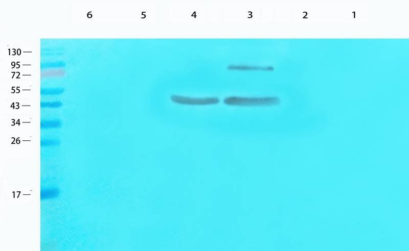 CDKN2A Rabbit Polyclonal Antibody