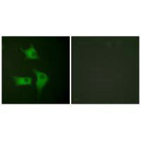 CDKN2B Antibody