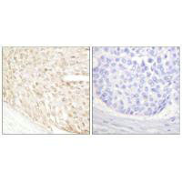 CDKN2C Antibody