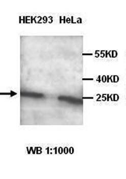 CDKN2C Rabbit Polyclonal Antibody