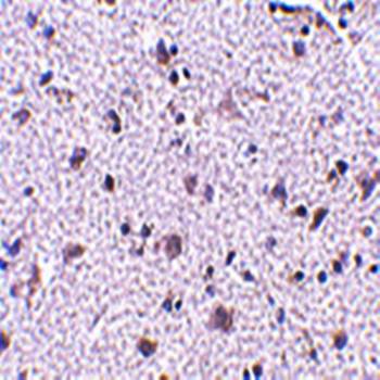 CDNF Rabbit Polyclonal Antibody