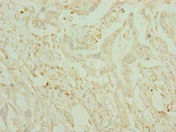 CDO1 Antibody