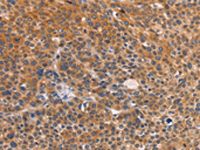 CTSC Antibody