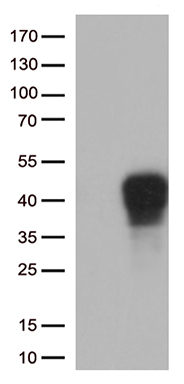 CENPJ Antibody