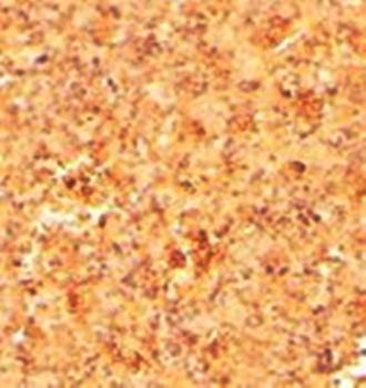 CFC1/Cripto-1 Antibody