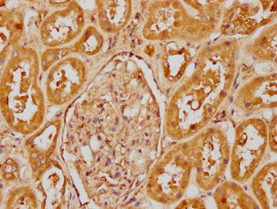 CFHR1 Antibody