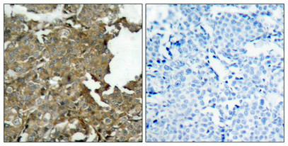 CFL1 Antibody