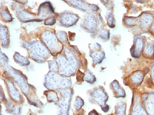 CGB3, CGB5, CGB8, NA Antibody