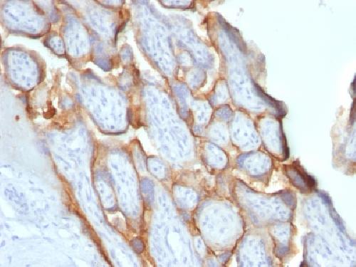 CGB3, CGB5, CGB8, NA Antibody