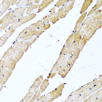 CALCB polyclonal antibody
