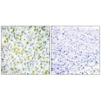 CHD4 Antibody