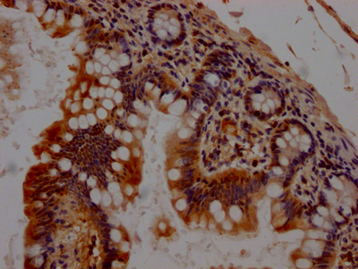 CHEK1 Antibody