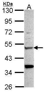 ADAR1 Rabbit Polyclonal Antibody