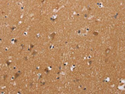 CHRNA4 Antibody