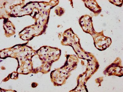 CHSY1 Antibody