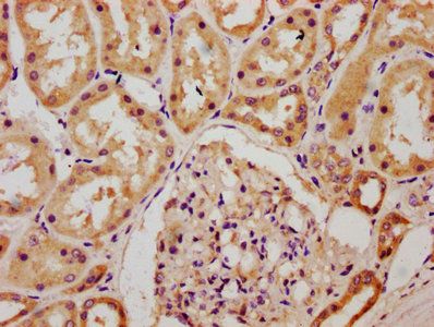 CHSY1 Antibody