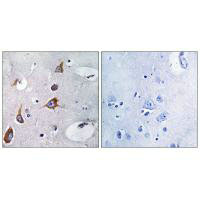 CHSY1 Antibody