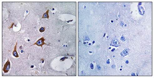 CHSY1 Antibody