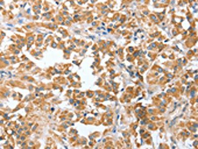 CIAPIN1 Antibody