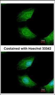 CIAPIN1 Rabbit Polyclonal Antibody