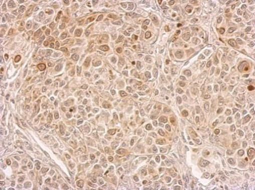 CIAPIN1 Rabbit Polyclonal Antibody