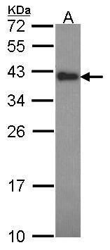 CIAPIN1 Rabbit Polyclonal Antibody
