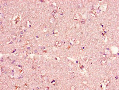 CIDEA Antibody