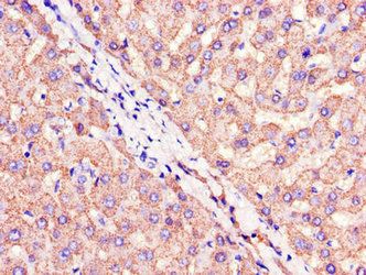 CIDEA Antibody