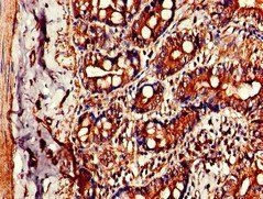 CIDEB Antibody