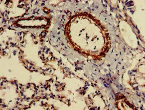 CIDEB Antibody