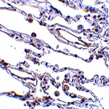 CIKS Rabbit Polyclonal Antibody