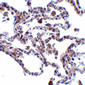 CIKS Rabbit Polyclonal Antibody