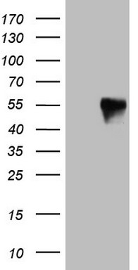 CSNK1E Antibody