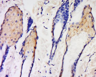 Krt42 Rabbit Polyclonal Antibody