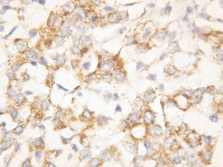 Cytokeratin 8/KRT8 Rabbit Polyclonal Antibody