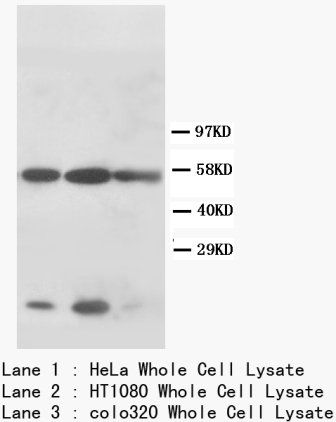 Cytokeratin 8/KRT8 Rabbit Polyclonal Antibody
