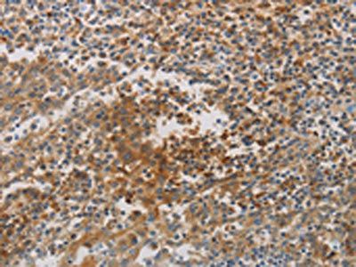 CKMT1A Antibody
