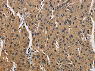 CKMT2 Antibody