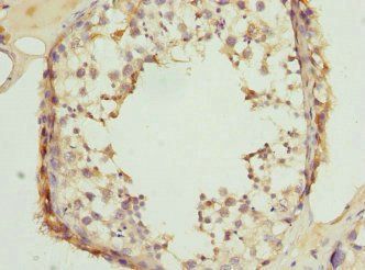 CLASP1 Antibody