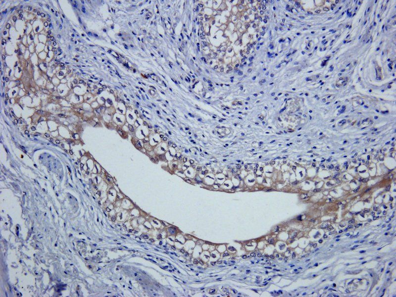 Claudin 1 Rabbit Polyclonal Antibody