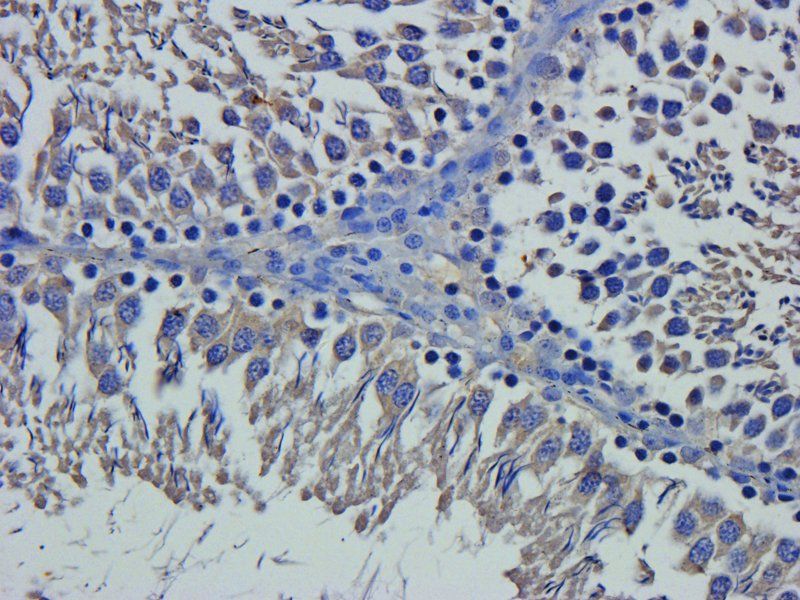 Claudin 1 Rabbit Polyclonal Antibody