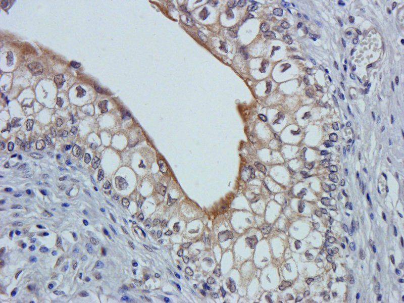 Claudin 1 Rabbit Polyclonal Antibody