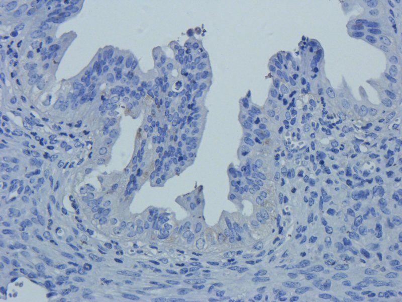 Claudin 5 Rabbit Polyclonal Antibody